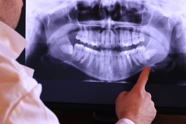 Emergency Gum Pain Relief in MT
