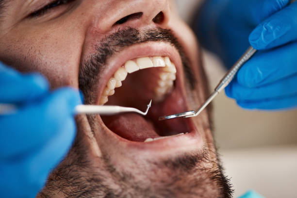 Tooth Infection Emergency Dentist in MT